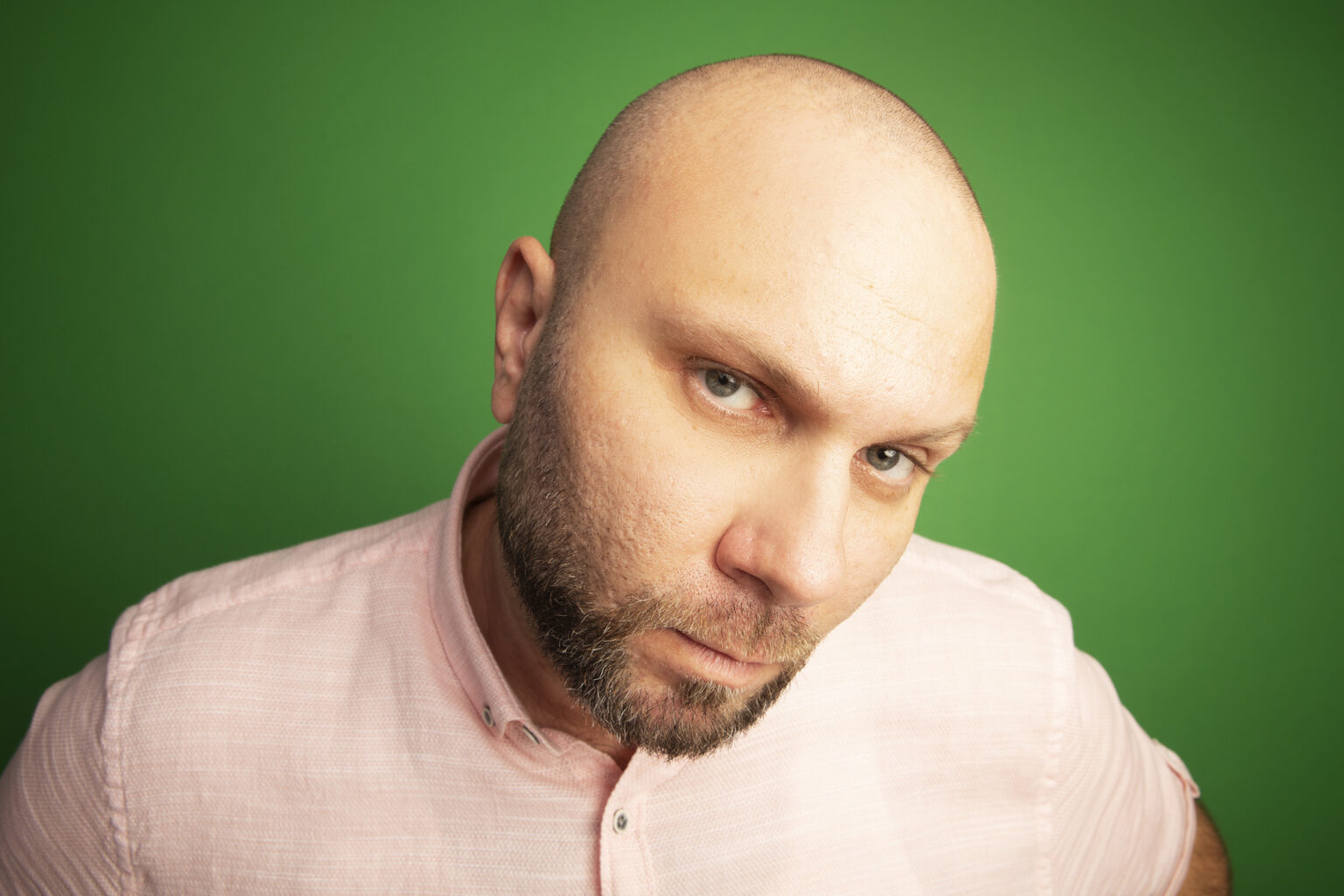 Male Pattern Baldness: Causes, Treatments, and What Really Works