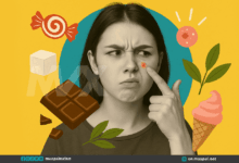 Does Sugar Cause Acne? 7 Ways to Clear Your Skin