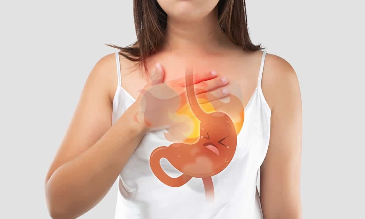 Heartburn Causes and Relief: Quick Tips to Stop the Burn