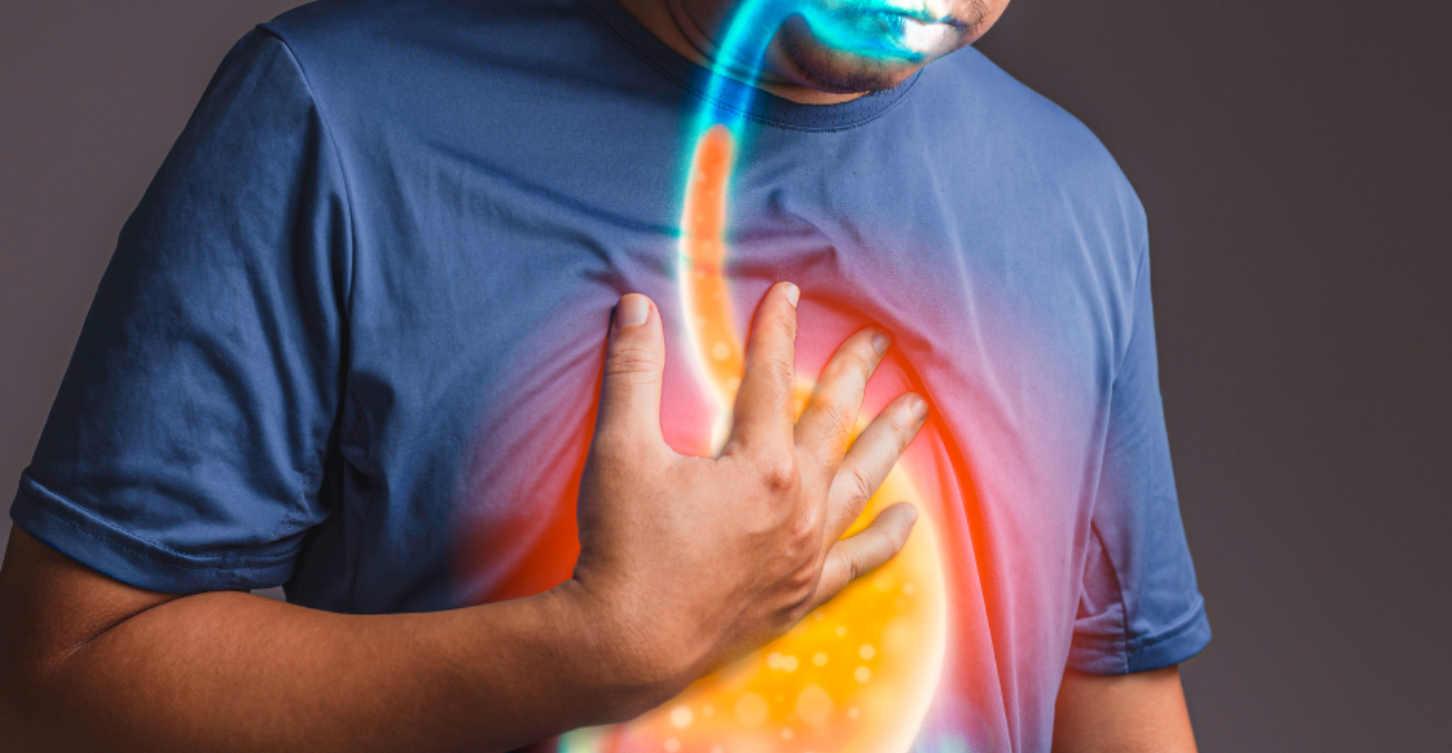 Heartburn Causes and Relief: Quick Tips to Stop the Burn