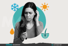 Winter Hair Loss: Why Your Hair Sheds More in Cold Weather