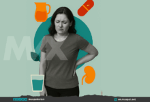 Kidney Stone Treatment: Natural Ways to Help Your Body Pass and Prevent Stones