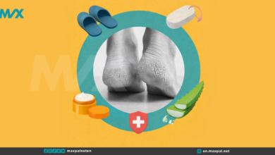 Cracked Heels Home Remedies: Gentle Ways to Soothe Dry, Painful Feet