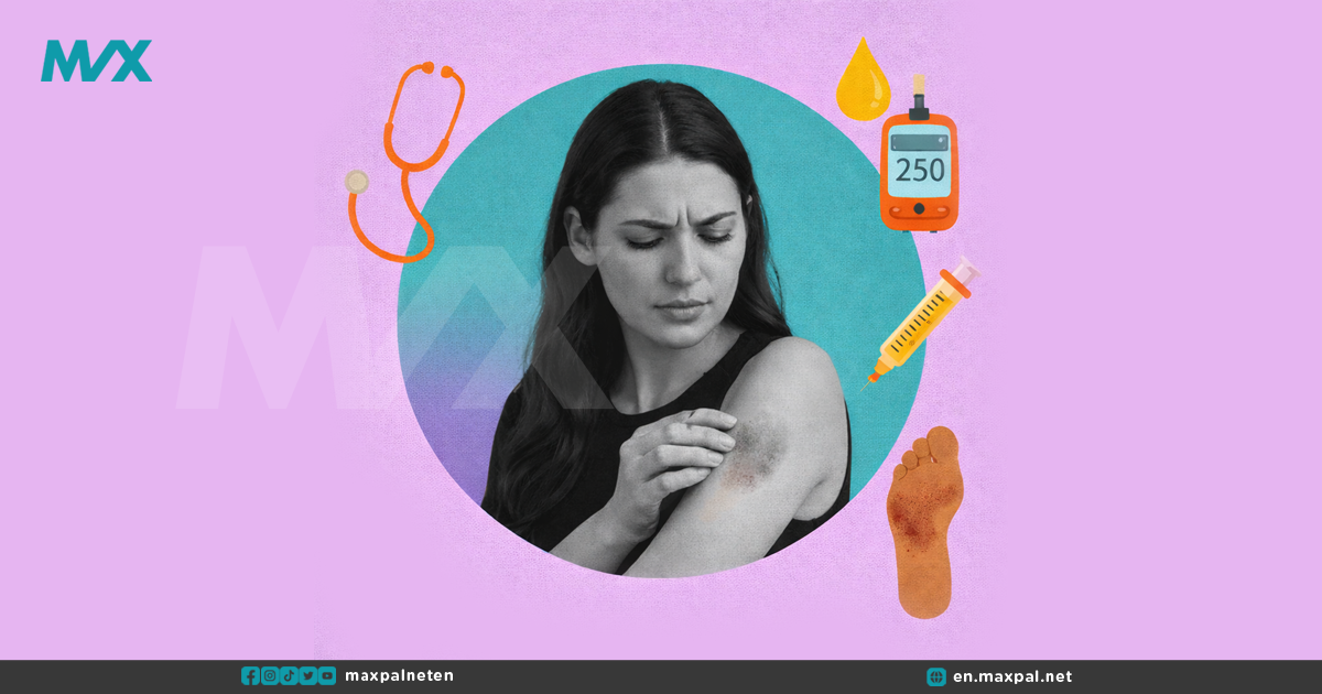 Diabetes Skin Symptoms: Shin Spots and Yeast Rashes