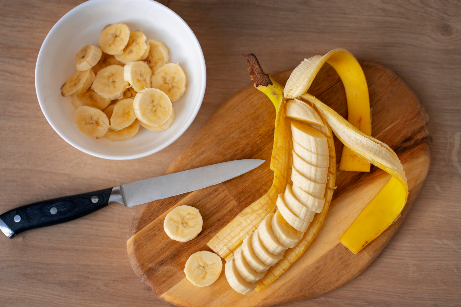 Banana Benefits: Nutrition Facts, Everyday Uses, and When to Be Cautious